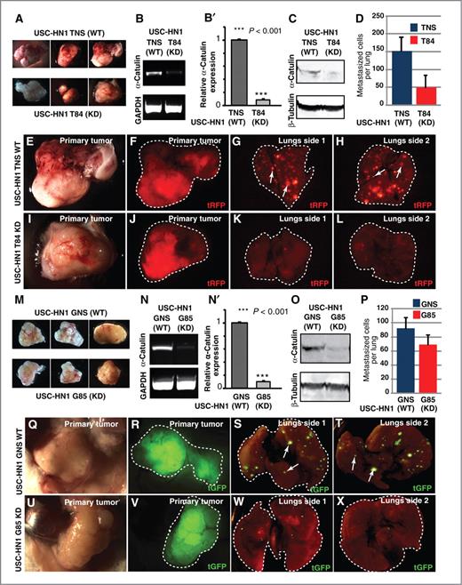 Figure 5. Ablation of α-catulin in hSCC cell lines decreases their metastatic potential in xenotransplants in vivo. Upon injecting hSCC USC-HN1 TNS (A) and USC-HN1 GNS (M; nonsilencing control cells) and hSCC USC-HN1 T84 and USC-HN1 G85 (α-catulin knockdown cells) into NOD.Cg mice, tumors of similar sizes formed. The specific knockdown of α-catulin in hSCC USC-HN1 T84 and G85 cells compared with the nonsilencing control hSCC USC-HN1 TNS and GNS cells, was confirmed by RT-PCR (B and N), real-time qPCR (B′ and N′), and Western blotting (C and O). E–L and Q–X, tumors formed from control cells (top) and α-catulin knockdown cells (bottom) show a dramatic decrease in cells that metastasized to the lungs, as visualized by tRFP (E–L) and tGFP (Q–X) expression, in α-catulin–deficient xenografts. Arrows show metastatic groups of cells. D and P, quantification of metastatic foci formed in the lungs from the injection of control and α-catulin–deficient USC-HN1 tumor cells. Standard error bars are shown. (n = 3 for TNS/T84 lentiviral system and n = 5 for GNS/G85 lentiviral system). ***, statistical significance was assessed by t test (P < 0.001).