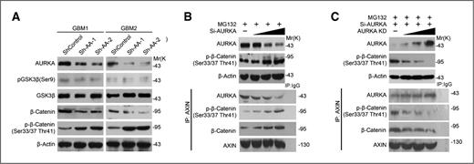 Figure 5. AURKA stabilizes β-catenin by directly inhibiting GSK3β or by sequestering with AXIN in the β-catenin destruction complex. A, GBM1 and GBM2 primary cells that express control vector or AURKA shRNA were treated with 10 μmol/L MG132 for 12 hours. Western blotting was conducted to detect the indicated proteins. B, GICs were transfected with increased doses of siAURKA, and 10 μmol/L MG132 was added 48 hours posttransfection. Immunoprecipitations (IP) were conducted using anti-AXIN antibodies, and Western blotting was used to detect the indicated proteins. C, GICs were cotransfected with siAURKA; an increased dose of AURKA KD (D247A) mutant plasmid, and 10 μmol/L of MG132 were added 48 hours posttransfection. Immunoprecipitations were conducted using anti-AXIN antibodies, and Western blotting was used to detect the indicated proteins.