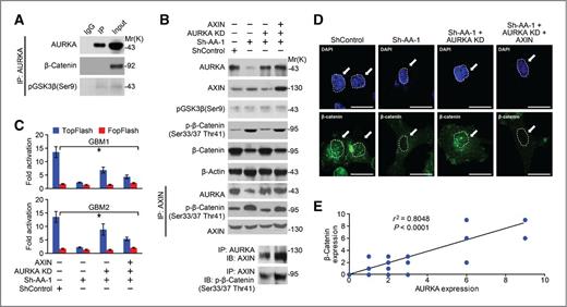 Figure 6. AXIN rescues AURKA-induced Wnt signaling activation. A, GIC cells were lysed after 10 mmol/L MG132 treatment, and immunoprecipitation (IP) was conducted using the anti-AURKA antibody. The protein binding of pGSK3β (Ser9) and β-catenin was analyzed by Western blotting. B, GIC cells that express shControl/AURKA shRNA were transiently transfected with AURKA KD or cotransfected with AURKA KD and AXIN. Forty-eight hours posttransfection, cells were lysed, and an equal amount of protein was used for the immunoprecipitation analysis and Western blotting. C, GIC cells expressing AURKA shRNA were transiently transfected with AURKA KD or cotransfected with AURKA KD and AXIN. Then, the TopFlash and FopFlah luciferase reporter assays were conducted to examine Wnt signaling activity. D, dissociated GIC cells expressing control or AURKA shRNA were plated on coverslips that had been precoated with poly-L-ornithine and fibronectin and then transiently transfected with AURKA KD or cotransfected with AURKA KD and AXIN. Forty-eight hours posttransfection, immunofluorescence was conducted using anti-β-catenin antibodies to examine the β-catenin subcellular localization. Bars represent 5 μmol/L. E, the expression of AURKA and β-catenin was examined via immunohistochemical staining in 40 glioblastoma specimens. Left: representative β-catenin and AURKA expression levels are shown in 3 glioblastoma tumor sections. Right: staining of AURKA or β-catenin was scored from 1 to 4. The correlation was significant, as determined by Pearson correlation test (r2 = 0.8048; P < 0.001).