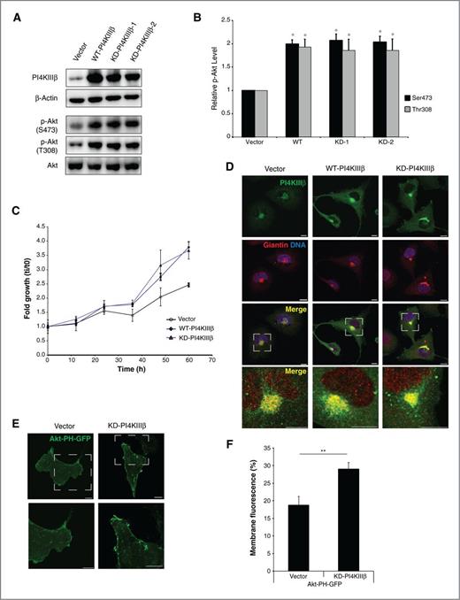 Figure 5. Ectopic expression of a catalytically inactive (D656A) PI4KIIIβ leads to Akt activation. A, Western blot analysis showing increased levels of phosphorylation of Akt at Thr308 and at Ser473 in WT and two independently derived KD-PI4KIIIβ–expressing BT549 cell lines as compared with the vector control. B, relative increase in Akt phosphorylation over total Akt levels is shown in the WT-PI4KIIIβ and KD-PI4KIIIβ–expressing cell lines as compared with the vector control. Data, mean ± SE of the mean of three independent experiments; statistical significance: *, P < 0.05 (Student t test). C, KD-PI4KIIIβ–expressing BT549 cells (closed symbol-triangle-purple line) proliferate at a faster rate than vector control cells (open symbol) and at a comparable rate as WT-PI4KIIIβ–expressing cells (closed symbol-diamond-blue line). D, confocal images of PI4KIIIβ localization (green) in vector control, WT- PI4KIIIβ–overexpressing, and KD-PI4KIIIβ–expressing cells. Golgi, as identified by the cis-medial Golgi marker Giantin, is seen in red and DNA is blue. Scale bars, 10 μm. E, confocal images of BT549 vector control and KD-PI4KIIIβ–expressing cells transfected with the PI(3,4,5)P3/PI(3,4)P2 reporter, Akt-PH-GFP. Scale bars, 10 μm. F, quantification of the plasma membrane recruitment of the Akt-PH-GFP reporter in the vector control and KD-PI4KIIIβ–expressing cells presented as the mean ± SE of the mean for 20 cells from four independent experiments. Statistical significance (**, P < 0.01, Student t test) is indicated.