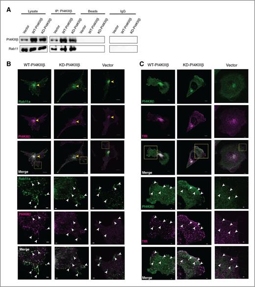 Figure 6. PI4KIIIβ interacts with Rab11 in vector control, WT-PI4KIIIβ–overexpressing, and KD-PI4KIIIβ–expressing cells. A, coimmunoprecipitation (Co-IP) was performed on whole-cell lysates of vector control, WT-PI4KIIIβ–expressing, and KD-PI4KIIIβ–expressing BT549 cells. Each lane contains 10 μg of total protein. coimmunoprecipitation was performed using a PI4KIIIβ-specific antibody. Agarose beads alone were used as a negative control. Interacting proteins were identified by Western blot analysis using PI4KIIIβ and Rab11a antibodies. B, top, confocal images of Rab11a (green) and PI4KIIIβ (magenta) in the vector control, WT-PI4KIIIβ–expressing, and KD-PI4KIIIβ–expressing BT549 cell lines. Scale bars, 5 μm. Bottom, higher magnification of yellow inset in the merge panel marking Rab11a vesicles (white arrow). Scale bars, 1 μm. C, top, confocal images of PI4KIIIβ (green) and the recycling endosome marker, TfR (magenta), in the vector control, WT-PI4KIIIβ–overexpressing, and KD-PI4KIIIβ–expressing BT549 cell lines. Scale bars, 5 μm. Bottom, higher magnification of yellow inset in the merge panel with TfR vesicles marked (white arrow). Scale bars, 1 μm.