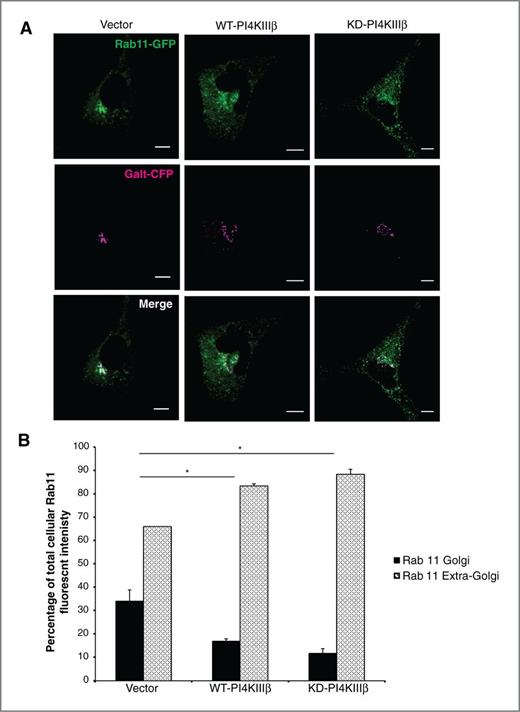 Figure 7. PI4KIIIβ-expression alters the cellular distribution of Rab11a. A, confocal images taken during live cell imaging of vector control, WT-PI4KIIIβ–expressing, and KD-PI4KIIIβ–expressing BT549 cells cotransfected with Rab11-GFP and Galt-CFP (Golgi marker; pseudo-colored magenta). Scale bars, 10 μm. B, quantification of the Golgi and extra-Golgi distribution of GFP-Rab11a in vector control, WT-PI4KIIIβ–overexpressing, and KD-PI4KIIIβ-expressing BT549 cells, presented as the mean ± SE of the mean, proportion of total cellular GFP fluorescence in 15 cells from each cell line. Statistical significance (*, P < 0.05, Student t test) is indicated.