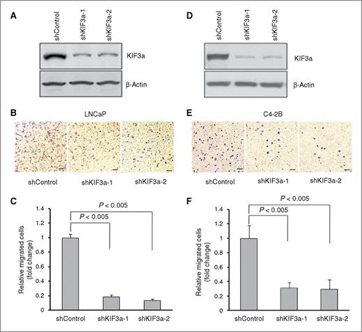 Figure 3. Effects of KIF3a depletion on PCa cell migration and invasion. A to C, cell migration analysis of LNCaP cells with lentiviral shRNA–mediated depletion of KIF3a or shRNA control. Cells that migrated through Transwell microporous membrane were fixed in methanol and stained with crystal violet. A, KIF3a knockdown efficiency was determined using Western blotting as shown. β-Actin was used as a loading control. B, photos are representative fields of migration cells on the membrane. Scale bars, 100 μm. C, bar graphs represent the relative fold difference of migrated cell numbers compared with control cells. P < 0.005 compared with shRNA control–transducted cells. D to F, effects of KIF3a depletion on invasion of C4-2B cells. C4-2B cells transduced with scramble shRNA, KIF3a shRNA-1, or KIF3a shRNA-2 were plated on Matrigel-coated Transwell filters containing 10% FBS in the bottom well. Cells that migrated through Matrigel-coated Transwell membrane were fixed in methanol and stained with crystal violet. D, KIF3a knockdown efficiency was determined using Western blotting as shown. β-Actin was used as a loading control. E, representative images of cells on the Transwell filters. Scale bars, 100 μm. F, the numbers of invading cells were counted and the invasion values are shown as fold change of invading cells relative to control with the means ± SD of three experiments performed in triplicate. P < 0.005 compared with shRNA control cells.