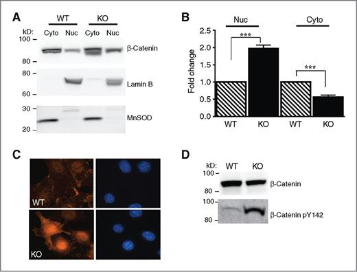 Figure 1. Nuclear β-catenin levels are elevated in Sirt2 KO MEFs. A, immunoblot analysis of enriched nuclear and cytoplasmic fractions for β-catenin, lamin B (nuclear marker), or manganese superoxide dismutase (cytoplasmic marker) showing increased nuclear β-catenin protein level in Sirt2 KO MEFs. B, densitometric analysis of the subcellular fractionation. ***, P < 0.001. C, β-catenin immunofluorescent staining showing markedly increased level of nuclear β-catenin in Sirt2 KO MEFs versus WT. D, immunoblot analysis showing increased pY142 β-catenin in Sirt2 KO MEFs.