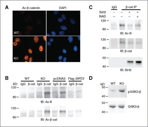 Figure 3. Acetylation of β-catenin and activation of the Wnt signaling pathway in Sirt2 KO MEFs. A, acetylated β-catenin immunofluorescent staining showing markedly increased level of acetylated β-catenin present in Sirt2 KO MEFs compared with WT. B, increased acetylated β-catenin is present in Sirt2 KO MEFs. Whole-cell lysates from Sirt2 WT and KO cells or from pcDNA3 and Flag-SIRT2 transfected U87 cells were immunoprecipitated with rabbit IgG control or β-catenin antibody. Pulled-down complexes were immunoblotted with acetylated lysine or acetylated β-catenin antibody. C, SIRT2 deacetylates β-catenin in vitro. Immunoprecipitated β-catenin from Sirt2 KO MEFs was incubated with or without purified recombinant SIRT2 in the presence or absence of NAD+. The reaction mixtures were separated by SDS-PAGE and immunoblotted with antibodies against acetylated lysine, β-catenin, or SIRT2. D, immunoblot analysis showing upregulated level of activated, phosphorylated GSK-3-β in Sirt2 KO MEFs compared with WT.