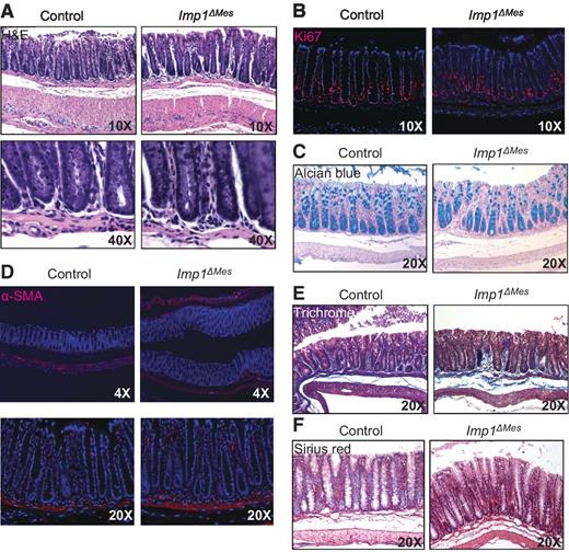 Figure 1. Stromal Imp1 is dispensable for colon homeostasis. A, representative H&E staining from control and Imp1ΔMes mice demonstrates no morphologic differences in colon crypts or mesenchymal layers. B, Ki67 staining is comparable between control and Imp1ΔMes mice. C, staining for goblet cell lineage via Alcian blue showed no significant differences between control and Imp1ΔMes mice. To evaluate stromal components, staining for αSMA (D), Masson's trichrome (E), and Sirius red (F) was performed; however, no differences were observed between control and Imp1ΔMes mice.