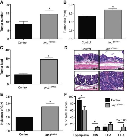 Figure 2. Imp1 loss in stromal cells promotes enhanced tumorigenesis. Tumors were induced in control and Imp1ΔMes mice using the AOM/DSS model. Tumors were evaluated 10 weeks after the initial AOM injection. A–D, Imp1ΔMes mice exhibited a significant increase in tumor number, size, and load compared with control mice. N ≥ 5 animals per genotype. E, histologic analysis of AOM/DSS tumors revealed an increase in the incidence of GIN in Imp1ΔMes mice compared with controls. Furthermore, Imp1ΔMes mice exhibited a significantly higher percentage of more histologically advanced lesions compared with controls, whereas control lesions were most often characterized as hyperplasia (F; LGA = low-grade adenoma; HGA = high-grade adenoma). Evidence of adenocarcinoma was only observed in Imp1ΔMes mice; however, lesions did not meet the full scoring criteria and were thus considered HGA. P values are indicated for individual histograms; *, P < 0.05 is considered statistically significant.