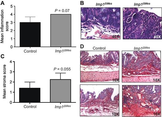 Figure 3. Imp1ΔMes mice exhibit increased tumor inflammation and stroma compared with controls. A, blinded histologic scoring of inflammation in AOM/DSS colons revealed a trend for increased inflammation in Imp1ΔMes mice compared with control. Examples from the more severe inflammation and necrosis within tumors of higher histologic grade from Imp1ΔMes mice are shown in B. C, the mean stroma score in Imp1ΔMes mice approached significance compared with control. D, representative images of Sirius red staining, where dark-red staining, collagen-positive staining is enhanced in Imp1ΔMes mice. P values are indicated for individual histograms.