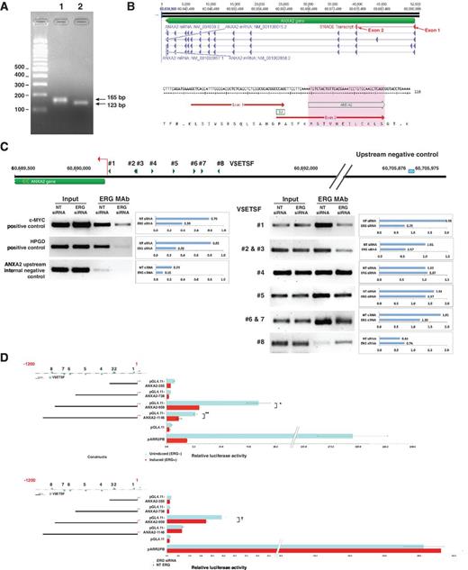 Figure 2. Mapping of prostate-specific ANXA2 transcript, analysis of ERG binding, and transcription regulation ANXA2 promoter. 5′RACE analysis identified a prostate-specific transcript (A). The 5′ end of the transcript is spliced together from exons 1 and exon 2 (red triangles) of ANXA2 mRNA, variant 1 (NM_001002858.2), and variant 3 (NM_004039.2), and is translated starting from exon 2 (B). ChIP of chromatin from NT and ERG siRNA treated VCaP cells using ERG MAb showed relatively strong recruitment of ERG to V$ETSF motifs #1, #2, #3, #6, and #7. The ratio of immunoprecipitated chromatin to input chromatin is shown adjacent to each amplified region. The recruitment of ERG to the C-MYC and HPGD promoter regions were evaluated as positive controls and a region upstream of ANXA2 promoter was tested as a negative control (C). Analysis of luciferase reporter constructs containing ANXA2 promoter upstream sequences transfected in doxycycline-inducible ERG-expressing LNCaP-LTE3 cell line (D, top; *, P < 0.05; **, P < 0.05) and in NT and ERG siRNA-treated VCaP cells (D, bottom; †, P < 0.05). Mean relative luciferase activities were calculated from triplicate transfections.