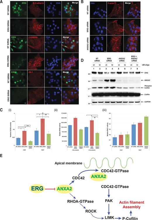 Figure 4. A, the knockdown of ERG promotes the reversal of EMT and reestablishes the polarized epithelial phenotype of the VCaP cells, demonstrated by the overexpression of determinants of the polarized epithelial cells, and components of the AJ (E-cadherin and β-catenin) and TJ (ZO-1). B, compared with control NT-siRNA, knockdown of ERG increases organized f-actin polymerization, while knockdown of ANXA2 results in disorganized f-actin network. Cells were fixed and stained with Alexa Fluor-594 phalloidin 72 hours after transfection. C, ERG inhibits the CDC42 and RHOA activity through repression of ANXA2. The relative activity of activated GTP-bound forms of (i) CDC42, (ii) RHOA, and (iii) RAC1 in were measured by G-LISA assays 72 hours after siRNA transfection (C; two-tailed Student t test: *, P < 0.05; **, P < 0.05; ***, P < 0.05; †, P < 0.05; ††, P < 0.05; †††, P < 0.05; ‡, P < 0.05; ‡‡, P < 0.05). The expression of phosphorylated cofilin is enhanced by ERG knockdown (lanes 3 and 4), but is reduced by ANXA2 (lanes 5 and 6) and by combined ERG and ANXA2 knockdown (lanes 7 and 8; D). ERG regulates the transition between the polar-differentiated epithelial phenotype and the mesenchymal phenotype by inhibiting CDC42 and RHOA-mediated actin-polymerization through the repression of ANXA2 (E).