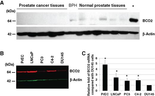 Figure 1. BCO2 expression is downregulated in human prostate cancer tissues and cell lines. A, BCO2 protein expression in normal human prostate, BPH, and prostate cancer tissues. The positive control lane (+) contains protein extracted from HEK-293 cells engineered to overexpress the bco2 gene. Western blot analysis was conducted using anti-rabbit antibody against BCO2 protein N-terminal peptide. A representative tissue blot is shown. B, BCO2 expression in normal PrEC and prostate cancer cell lines LNCaP, PC3, C4-2, and DU145. Cell lysates were isolated and 30 μg of protein was subjected to NuPAGE. Equal loading of protein was confirmed by reprobing with a β-actin monoclonal antibody. C, real-time RT-PCR of bco2 gene expression in normal PrEC and the prostate cancer cell lines LNCaP, PC3, C4-2 and DU145. Total RNA was isolated from indicated cell lines, and real-time RT-PCR was performed as described in “Materials and Methods.” Relative fold bco2 expression is presented as 2−ΔΔCt relative to the ΔΔCt of DU145 cells. Data, mean ± SD (n = 3). *, P < 0.05.