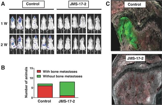 Figure 4. CX3CR1 inhibition shows long-term antitumor effects. A, mice were inoculated via the left cardiac ventricle with MDA-231 cells, stably expressing both GFP and luciferase, and previously incubated with either vehicle or JMS-17-2. Tumor growth was monitored by in vivo bioluminescence imaging for two weeks postinoculation until euthanasia. Treatment with JMS-17-2 caused a dramatic reduction of tumors in both skeleton and visceral organs. B, only one of eight animals inoculated with cancer cells preincubated with the CX3CR1 antagonist presented with tumors, in contrast with six of the seven animals in the control group. C, tissues were harvested under bioluminescence guidance and inspected for fluorescence to confirm the presence or absence of tumor lesions at the histologic level, as shown by two representative images. Magnification, 200×.