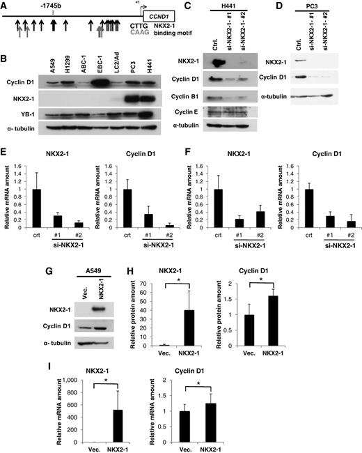 Figure 1. Depletion of NKX2-1 decreases expression of cyclin D1 in NSCLC. A, Schematic representation of the 5′ promoter region of human cyclin D1. Potential NKX2-1–binding sites CTTG (black) and GAAC (gray) are indicated by arrows. B, Expression of NKX2-1 and cyclin D1 in human lung cancer cell lines. Whole-cell lysates prepared from seven human lung cancer cell lines as indicated were subjected to immunoblotting with the indicated antibodies. C–F, Effects of NKX2-1 depletion on cyclin D1 expression in human lung cancer cell lines. NKX2-1 siRNAs or control siRNA were transfected into H441 (C, E) and PC3 (D, F) cells for 48 hours, and then their lysates were subjected to immunoblotting with the indicated antibodies (C, D). Total RNA was prepared, and relative mRNA levels of NKX2-1 and cyclin D1 were measured by qRT-PCR (E, F). Columns represent the mean of three independent experiments, and error bars indicate SD. G–I, Supplementation of NKX2-1 in NKX2-1–negative cells promoted cyclin D1 expression. A549 cells, an NKX2-1–negative cell line, were transfected with the Myc-DDK-NKX2-1 plasmid or control vector. Whole-cell lysates were subjected to immunoblotting with the indicated antibodies (G, H). Total RNA was prepared, and relative mRNA levels of NKX2-1 and cyclin D1 were measured by qRT-PCR (I). Columns represent the mean of three independent experiments, and error bars indicate SD. *, P < 0.05.