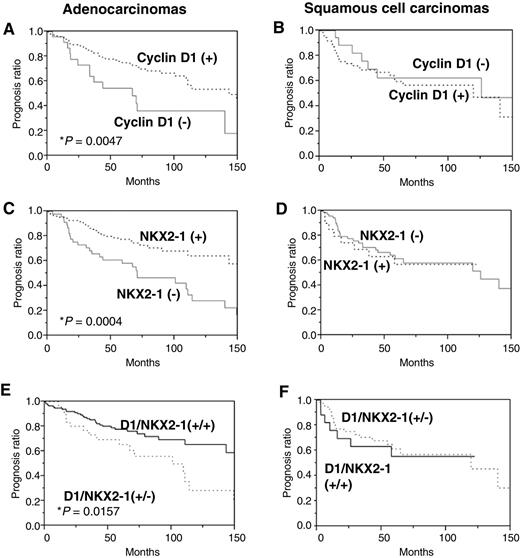 Figure 4. Relationship between the expression of NKX2-1 and cyclin D1 in the survival rate of patients with NSCLCs. The survival data and expression status of patients indicated in Table 1 was analyzed by the Kaplan–Meier method. The statistical significance of the data was evaluated by the log-rank test. A and B, Prognosis of cyclin D1-positive [cyclin D1(+)] and cyclin D1-negative [cyclin D1(−)] adenocarcinomas (A) and squamous cell carcinomas (B). C and D, Prognosis of NKX2-1-positive [NKX2-1(+)] and NKX2-1-negative [NKX2-1(−)] adenocarcinomas (C) and squamous cell carcinomas (D). E and F, Prognosis of cyclin D1(+)/NKX2-1(+) and cyclin D1(+)/NKX2-1(−) adenocarcinomas (E) and squamous cell carcinomas (F).