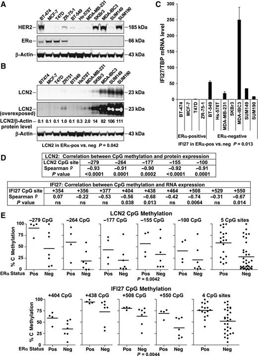 Figure 6. LCN2 and IFI27 expression inversely associates, whereas CpG methylation directly associates with ERα status in breast cancer cell lines. A, Characterization of HER2 and ERα protein expression. B and C, LCN2 protein (B) and IFI27 RNA (C) expression levels. For both LCN2 and IFI27, expression levels were scaled relative to their median value (ZR751 cells for LCN2, and T47D cells for IFI27). LCN2 and IFI27 expression inversely associated with ERα+ status. For both genes, expression values were log2 transformed because their variances were significantly different between ERα+ and ERα− cell lines (both P < 0.0001, F test). Significance was assessed using two-tailed unpaired t tests. HER2, ERα, and LCN2 protein levels were measured by immunoblotting and IFI27 mRNA levels by qRT-PCR. D, Correlation between CpG methylation and expression in breast cancer cell lines. Correlations were determined using Spearman ρ coefficient and a one-tailed P value. E, LCN2 and IFI27 CpG methylation levels positively associated with ERα status. Only those CpG sites that showed a significant inverse correlation between methylation and gene expression by Spearman ρ were evaluated for an association with ERα status. Significance was assessed considering all tested CpG sites together using two-tailed paired t tests in which CpG methylation levels were paired by site location. Individual CpG sites are presented to show pairings. The line in the ERα-positive and -negative subgroups represents the mean methylation value. Methylation levels were quantitated by pyrosequencing of bisulfite-treated gDNA.