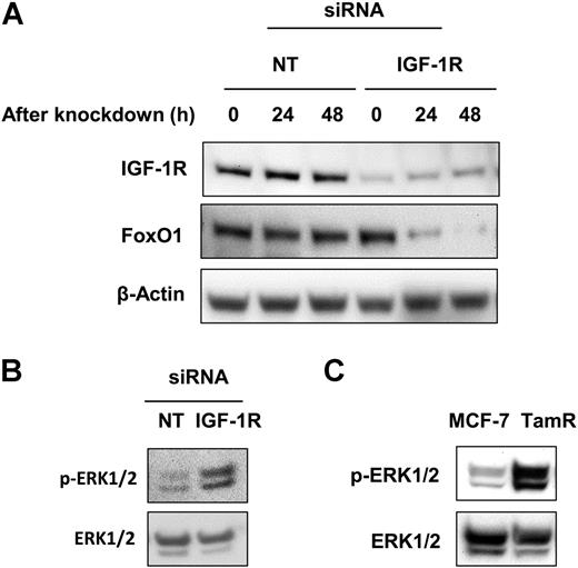 Figure 5. IGF-1R knockdown induces the accumulation of p-ERK1/2 and decreased FoxO1 protein levels. A, FoxO1 expression over 48 hours after IGF-1R knockdown in MCF-7. B, Accumulation of p-ERK1/2 after IGF-1R knockdown in MCF-7 cells. C, Accumulation of p-ERK1/2 in MCF-7 and TamR cells. *, P < 0.05. Results are average or representative of 3 independent experiments. Error bars are SEM.