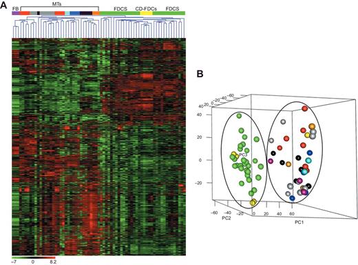 Figure 1. Unsupervised analysis (1,683 genes). A, Hierarchical clustering comparing FDC sarcomas, microdissected Castleman FDCs, other mesenchymal sarcomas, and fibroblasts. In the matrix, each row represents a gene and each column represents a sample. The color scale illustrates the relative expression level of a gene across all samples: red represents an expression level above the mean and green represents expression lower than the mean. B, PCA plot shows to which extent the different biologic samples group together. In particular, the percentage of variance explained by the 3 main components was 42.65% (component 1, x-axis: 25.36%; component 2, y-axis: 11.56%; and component 3, z-axis: 5.73%). FDC sarcomas (FDCS), green; microdissected Castleman FDCs (CD-FDCs), yellow; fibroblast (FB), purple; other nesenchymal tumors (MTs): desmoid-type fibromatosis (DF), blue; dermatofibrosarcomas protuberans (DFSP), red; fibromyxoid sarcomas (FMS), sky blue, inflammatory myofibroblastic tumors (IM ALK+ and IM ALK−), black; solitary fibrous tumors (SF), gray, hemangiopericytomas (HP), orange.