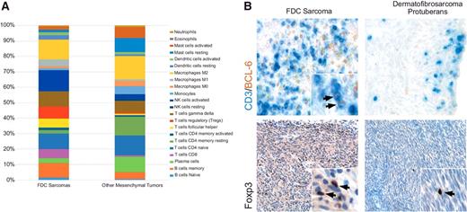 Figure 4. Immune cell landscape of FDC sarcomas compared with other mesenchymal tumors. A, CIBERSORT analysis identified a detailed enumeration of immune cell subsets from the gene expression profile. A different profile of immune cells with a significant enrichment of TFH, TREG, cytotoxic T cells (T cells CD8), NK cells activated population in FDC sarcoma, and plasma cells in the other mesenchymal tumor histotypes. B, Representative immunostainings showing the different frequency of CD3 (top, blue signal) and BCL-6 (top, brown signal) expressing bona fide TFH cells in an FDC sarcoma and in a dermatofibrosarcoma protuberans case. A similar difference is shown for the density of Foxp3 (bottom) expressing TREG cells in the 2 cases.