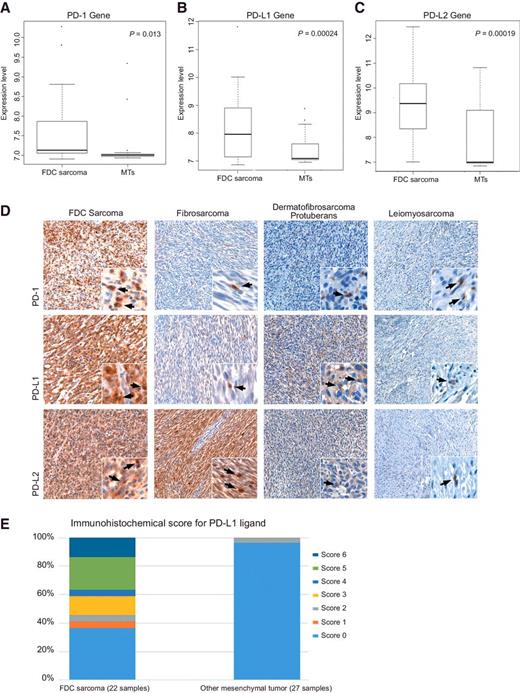 Figure 5. Correlation between PD-1, PD-L1, and PD-L2 mRNA expression levels in FDC sarcoma versus other mesenchymal tumors (MT). Box plot of significant difference of mRNA expression levels (A) PD-1, (B) PD-L1, and (C) PD-L2. D, Representative immunostainings showing PD-1 (top) expressing infiltrating immune cells and the conspicuous expression of PD-L1 (middle) and PD-L2 (bottom) ligands in a case of FDC sarcoma, as compared with a control dermatofibrosarcoma protuberans, fibrosarcoma, and leiomyosarcoma cases. E, Combined IHC score for PD-L1 ligand in TMAs constructed from 22 FDC sarcoma (FDCS) and 27 mesenchymal tumor samples.