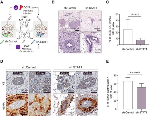 Figure 5. Stromal STAT1 influences progression of early-stage breast cancer lesions in vivo. A, Schematic depicting experimental strategy for intraductal injection experiments. Control CAFs were injected into one mammary fat pad (n = 5), while STAT1-depleted CAFs (shSTAT1) were injected into the contralateral fat pad (n = 5). After 24 hours, DCIS.COM cells were injected into the nipple of each mammary gland. B, Representative H&E images of tumor progress in glands injected with control CAFs (left) and shSTAT1 CAFs (right) at both 10× (top) and 40× (bottom). C, Mean percent of DCIS/IDC-like lesion per field of view in glands injected with control CAFs (n = 5) compared with glands injected with shSTAT1 CAFs (n = 5). D, Representative 40× images showing tumor lesions in glands injected with control CAFs (left) and shSTAT1 CAFs (right) stained with either human K8 (top row) or α-SMA (bottom row). DCIS, ductal carcinoma in situ; IDC, invasive ductal carcinoma; ADH, advanced ductal hyperplasia. E, Quantification of percent α-SMA+ cells per 40× field of view in 5-μm sections from mammary glands injected with sh.Control CAFs (left) or sh.STAT1 CAFs (right).