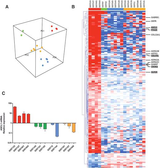 Figure 1. Gene expression of quadruple WT GIST. A, Three-dimensional representation of principal component analysis. The quadruple WT GIST (red), SDH (green), PDGFRA (blue), and KIT (yellow) mutated GIST cluster separately from each other. In particular, the quadruple WT subgroup can be separated along the second component (PC2 axis), indicating a strong evidence of a specific gene expression profile. B, Heat map representing the 247 differential expressed genes (q-value < 0.05) in the comparison between quadruple WT and mutated GIST. Enriched genes of Neuroactive ligand–receptor interaction pathway are shown on the right of the heat map. The neuroendocrine tumor genes are highlighted in gray. C, qRT-PCR evaluation of the ASCL1 mRNA expression level in an additional cohort of 8 SDH or KIT/PDGFRA mutated GIST. ASCL1 relative expression was calculated in 4 quadruple WT (red), in 3 SDH-deficient (green), and in 5 KIT/PDGFRA-mutated GIST (yellow and blue, respectively).