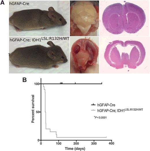 Figure 5. Broad CNS expression of mutant Idh1 induces hydrocephalus. A, Comparison of hGFAP-Cre [wild-type (n = 9); top row] and hGFAP-Cre; Idh1LSL:R132H/WT [mutant (n = 20); bottom row] animals. Gross observation shows head doming and squinted eyes of symptomatic animal (bottom, left). Mutant brains show large, fluid-filled cavities (bottom, middle). H&E staining indicates enlargement of the lateral ventricles and hydrocephalus in mutant brains (bottom, right). B, Kaplan–Meier survival curve comparing wild-type (hGFAP-Cre) animals (black curve, n = 9) and mutant (hGFAP-Cre; Idh1LSL:R132H/WT) animals (gray curve, n = 20).