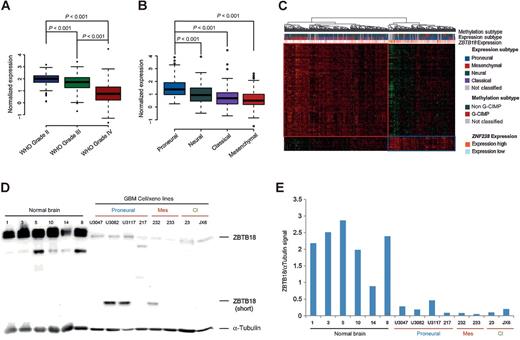 Figure 1. ZBTB18 is highly expressed in low-grade gliomas and proneural GBMs. A, Analysis of ZBTB18 expression in low- and high-grade glioma samples from TCGA. B, Analysis of ZBTB18 expression in GBM subtypes from TCGA samples. C, Cluster analysis showing association between expression of ZBTB18-correlating genes with methylation and tumor subtype in GBM samples from TCGA. ZBTB18 appears to be mostly expressed in proneural GBMs. D, Western blot showing ZBTB18 expression in normal brain tissues and GBM-derived cells. The low band represents a shorter ZBTB18 isoform. α-Tubulin was used as loading control. E, Densitometric analysis of the Western blot displayed in D. The ZBTB18 signal was normalized to the α-tubulin signal.