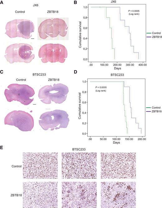 Figure 4. Expression of ZBTB18 affects tumor formation and survival in vivo. A, Hematoxylin and eosin (H&E) staining of representative tumors resulting from intracranial injection of JX6 cells infected with either control (left) or FLAG-ZBTB18 overexpressing vector (right) in immunocompromised mice. The scale bar represents 1 mm. B, Kaplan–Meier survival curves of mice intracranially injected with JX6 cells expressing full-length ZBTB18 or control vector (n = 8). C, H&E staining of representative mice tumors upon intracranial injection of BTSC233 cells infected with either control (left) or FLAG-ZBTB18 overexpressing vector (right) in immunocompromised mice. The scale bar represents 1 mm. D, Kaplan–Meier survival curves of mice intracranially injected in C (n = 9). E, Representative images of mice tumors resulting from intracranial injection of BTSC233 transduced with either control or FLAG-ZBTB18 stained with anti-MIB1 antibody. The scale bar represents 200 μm. A reduced proliferation or pattern of proliferating cells is observed upon ZBTB18 overexpression.