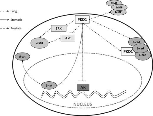Figure 4. Antiproliferative signaling pathways regulated by PKD1. The schematic representation illustrates how PKD1 may have antiproliferative actions in various tissues. PKD1 can inhibit downstream ERK and Akt pathways decreasing, in some tissues, S6K activity. PKD1 can inhibit AR transcriptional activity. It can also induce the membrane redistribution of E-cadherin and β-catenin, leading to the inhibition of the transcriptional activity of the latter. Furthermore, PKD1 can induce the expression of E-cadherin and metalloproteinases (MMP-2 and -9). β-cat, β-catenin; ERK, extracellular signal-regulated kinase; MMP, matrix metalloproteinases; PKD1, protein kinase D1; S6K, ribosomal S6 kinase.