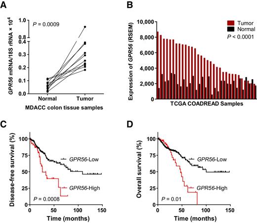 Figure 2. Association of GPR56 overexpression with poor survival outcome in colorectal cancer. A, qRT-PCR GPR56 expression data for 10 matched tumor and adjacent normal samples from M.D. Anderson Cancer Center. B, GPR56 RNA-Seq RSEM values for 32 matched tumor and adjacent normal from the TCGA colorectal adenocarcinoma (COADREAD) cohort. Statistical analysis was performed using paired t test (A and B). Kaplan–Meier plots of (C) disease-free (high, n = 58, low, n = 271) and (D) overall survival of patients from the TCGA COADREAD cohort (high, n = 67, low, n = 307). P values were obtained by the log-rank test.