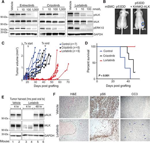 Figure 3. KANK2-ALK–driven smooth muscle cell tumors are highly sensitive to lorlatinib in vivo. A, Immunoblot analysis of phospho-ALK (pALK), total ALK (tALK), phospho-ERK (pERK1/2), and GAPDH (loading control) of lysates prepared from murine smooth muscle KANK2-ALK cells (mSMC) after 4-hour treatment with three different ALK inhibitors at indicated concentrations. B, IVIS bioluminescence imaging of mSMC p53DD compared with mSMC p53DD + KANK2-ALK; imaging performed 3 days after flank cell injection. C, Tumor volume of mice harboring mSMC p53DD + KANK2-ALK as measured by calipers. Treatment (Tx) began when tumor volume reached 0.2 mm3 [Tx arrowhead (gray)] and continued for 4 weeks. D, Kaplan–Meier survival analysis of treated animals. E, Immunoblot analysis of phospho-ALK (pALK), total ALK (tALK), and GAPDH (loading control) of lysates prepared from vehicle-treated compared with lorlatinib-treated mice. Lanes 3 and 4 contain lysate from tumors harvested 4 hours after the last dose of lorlatinib. Lanes 5 and 6 contain lysate from tumors harvested 48 hours after last dose of lorlatinib. F, Hematoxylin and eosin (H&E) stain and IHC from mSMC p53DD + KANK2-ALK tumors treated with vehicle (top row) or lorlatinib (bottom row). IHC was performed with phospho-S6 (pS6), and cleaved caspase-3 (CC3)-directed antibodies.
