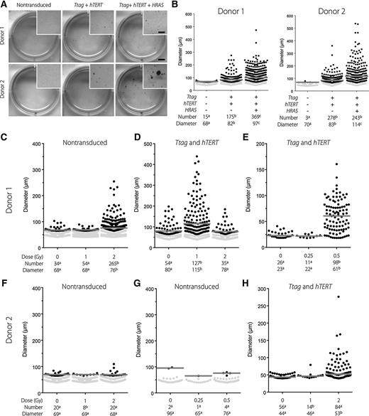 Figure 2. Anchorage assay of nontransduced, transduced with Ttag and hTERT and transduced with Ttag, hTERT, and HRAS BPECs from donors 1 and 2. A, Representative images of MTT-positive colonies. Bar, 5 mm; insert bar, 2.5 mm. B, Dot plot representing the median diameter of each colony (μm) and the total number of colonies formed for each condition. C–H, Anchorage-independent growth 8 weeks after exposure to moderate/low doses of radiation of nontransduced (C, F, and G) and partially transformed BPECs (D, E, and H) from donor 1 (C–E) and donor 2 (F–H). Dot plots represent the diameter of each colony and the total number of colonies analyzed for each condition. Dose, number of colonies formed, and median diameter are displayed for each condition. Gray dots indicate colonies discarded from the analysis due to insufficient size. Gray lines show median colony diameter for each group. Different letters indicate clustering of data in different groups of statistical significance for number (Fisher exact test; P < 0.05) and size of the colonies (Kruskal–Wallis test with multiple comparisons correction, P < 0.05).