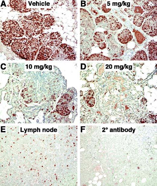 FIGURE 5. Celecoxib-induced inhibition of tumor cell proliferation in vivo in a dose-dependent manner. Light microscopy images of PCNA staining of mammary tumor sections from vehicle-treated (A) and celecoxib (5, 10, and 20 mg/kg)–treated (B-D) MTag mice. All images are representative of five standardized fields from six separate experiments. Inhibition of proliferation is most evident at 10 and 20 mg/kg dose of celecoxib. Lymph node section (E) and second antibody staining (F) are shown as controls. Magnification, ×200.