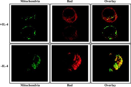FIGURE 3. Mitochondrial localization of Bad. IL-4-stimulated or IL-4-deprived cells (12 hours) were stained with anti-Bad and anti-mitochondria antibody (Mito 2813) followed by Cy3- and Cy2-labeled secondary antibodies, respectively, and analyzed by confocal microscopy. Similar results of three independent experiments. Single confocal sections show fluorescence in green and red.