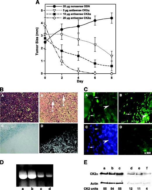 FIGURE 1. Effects of direct administration of antisense CK2α oligodeoxynucleotide in prostate cancer xenograft. A. Dose-dependent decrease in PC3-LN4 xenograft tumor size by a single injection of antisense CK2α. Groups of athymic nude mice (n = 5 for each group) were injected with PC3-LN4 (2 × 106 cells) into the subcutis. Once the tumors reached ∼3-5 mm in diameter, therapy was begun with a single dose of naked antisense CK2α oligodeoxynucleotide as phosphorothioate (5-20 μg in 100 μL PBS per tumor) delivered in and around each tumor. Tumor size was measured every second day. Treatment with 20 μg antisense CK2α caused a significantly greater and more rapid decrease in tumor size compared with 5 μg dose (P < 0.05, log rank); the differences from the control were significant at day 4 for the 5 μg dose and at day 2 for the 10 and 20 μg dose. Treatment with a 20 μg dose of the control nonsense oligodeoxynucleotide did not affect the progression of the tumor growth. Points, five tumors. In a parallel experiment, tumor tissue corresponding to 6-day time point with 10 μg/mL dose of antisense CK2α or nonsense oligodeoxynucleotide was subjected to TUNEL staining for quantitative analysis of the percentage apoptosis. Visual examination of the apoptotic cells in five different fields gave the values of 9 ± 5 and 56 ± 22 (% apoptotic cells ± SD) in nonsense versus antisense-treated xenograft tumor, respectively. B. Evidence of induction of apoptosis by antisense CK2α in the prostate cancer xenograft model. Animals were treated with 5 μg antisense CK2α as under A. At the end of 7 days, tissue sections of control (A) and treated (B) mice were stained for histology (H&E stain) and for apoptosis (TUNEL stain). Note individual cancer cells (B, arrow a) interspersed throughout necrotic and apoptotic stroma (B, arrow b). C, hematoxylin stain of the antisense CK2α-treated tumor tissue section. D, same section subjected to TUNEL staining. (Please note the nontumor tissue adjacent to the tumor at the top left of C and D.) C. FISH analysis of CK2α message in PC3-LN4 xenograft following treatment with antisense CK2α oligodeoxynucleotide. The xenograft was treated with 5 μg antisense CK2α oligodeoxynucleotide for 7 days as under A. Tissue sections were probed for the CK2α mRNA as described in Materials and Methods. A, antisense CK2α oligodeoxynucleotide treated and hybridized with CK2α probe; B, nonsense oligodeoxynucleotide control treated and hybridized with CK2α probe; C, same section as A but stained with bisbenzamide to identify cell nuclei; D, antisense CK2α oligodeoxynucleotide treated and hybridized with a nonsense probe. Large arrows, tumor nest interiors; small arrows, marginal cells. D. RT-PCR analysis of CK2α message in PC3-LN4 xenograft following treatment with antisense CK2 oligodeoxynucleotide. The xenograft was treated with 10 μg antisense CK2α oligodeoxynucleotide as under A, and tissue was harvested at day 7. RNA was isolated from the fresh tissue and subjected to RT-PCR analysis as described in Materials and Methods. Lanes a and b, control nonsense oligodeoxynucleotide treated; lanes c and d, antisense oligodeoxynucleotide treated. β-actin control reference gene is also shown for the same DNA templates. E. Immunoblot for CK2α and the associated CK2 activity in the cytoplasm and nuclear matrix fractions of PC3-LN4 tumor xenograft tissue corresponding to the 6-day time point and 10 μg/mL antisense or nonsense oligodeoxynucleotide. Lanes a-c, cytosolic fraction; lanes d-f, nuclear matrix fraction; lanes a and d, saline-injected controls; lanes b and e, nonsense oligodeoxynucleotide injected; lanes c and f, antisense CK2α oligodeoxynucleotide injected. The corresponding CK2 activity is shown as CK2 units (nmol 32P/mg protein/h); the variation in each of the activity assays was <5%. Actin immunoblot is shown to confirm that the sample loading was uniform for each of the fractions.
