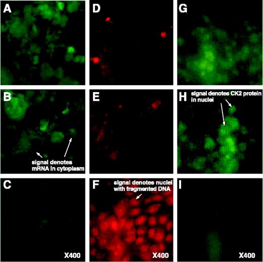 FIGURE 2. FISH analysis for CK2α mRNA, TUNEL assay, and immunostaining for CK2α following treatment of SCC-15 cells with antisense CK2α. Cells were grown in glass chamber slides to prepare them for treatment with 2 μg/mL phosphodiester CK2α oligodeoxynucleotides packaged in s-50 tenascin nanocapsules as the delivery vehicle (20). After a 12-hour incubation with the antisense CK2α oligodeoxynucleotide in tenascin nanocapsules, the cells were subjected to FISH analysis to detect the CK2α mRNA, TUNEL staining to determine the extent of apoptosis, and immunostaining for CK2α protein. A, D, and G. Control untreated cells. B, E, and H. Cells treated with control sense CK2α oligodeoxynucleotide. C, F, and I. Cells treated with antisense CK2α oligodeoxynucleotide. A, B, and C. FISH results. D, E, and F. TUNEL results. G, H, and I. Immunostaining for CK2α. In this experiment, the TUNEL analysis was carried out as described in Materials and Methods, except for the modification that monoclonal anti-BrdUrd (1:10, BD Biosciences) was detected by indirect immunofluorescence employing biotinylated donkey anti-mouse immunoglobulin G (1:200) and Cy3-conjugated streptavidin (1:800, Jackson ImmunoResearch) as secondary antibodies. Immunostaining for CK2α was as described in Materials and Methods.