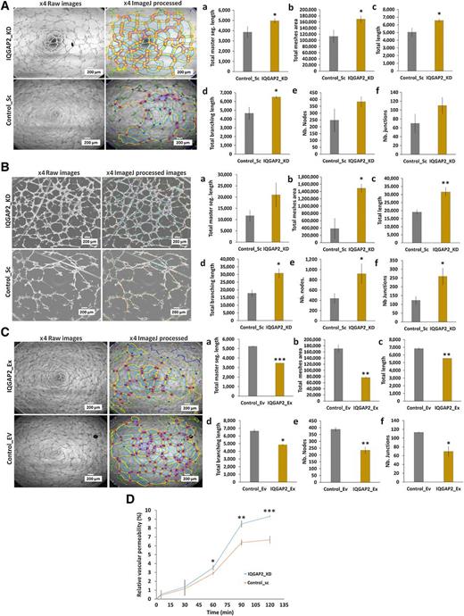Figure 2. IQGAP2 modulation in breast cancer cells influences tubule formation and vascular permeability of HUVECs. A–C, HUVECs were cultured with conditioned medium (CM) from IQGAP2 modulated breast cancer cell lines and tubule formation assay was performed. After 4 hours, images of tubules were captured at ×4 magnifications. Angiogenesis analyzer tool of ImageJ software was used to analyze various parameters, including, total master segment, length of tubules, total meshes area of tubes, total length of tubes, total branching length of tubes, total branching nodes, and total number of junctions. A, Representative capillary tubule structures (left) and processed skeletonized image (right) showing more tubule network in HUVECs treated with CM from the IQGAP2-depleted (IQGAP2_KD) MCF7 group than the empty vector control group (Control_Sc; n = 3). Bar graphs on the right (A, a–f) showing the difference in the various angiogenic parameters. B, Tubule structures (left) and processed skeletonized image (right) displaying increased tubule network in HUVECs cultured in medium conditioned with the IQGAP2-depleted (IQGAP2_KD) MDA-MB-468 group than the empty vector control group (Control_Sc; n = 3, two-tailed unpaired t-test). Bar graphs in the right panel (B, a-f) showing the differences in angiogenic parameters between IQGAP2 depleted (IQGAP2_KD) MDA-MB-468 and empty vector control group (Control_Sc; n = 3, two-tailed unpaired t test). C, Representative images of tubule structures showing reduction in tubule network in HUVECs in response to CM from IQGAP2 overexpression (IQGAP2_Ex) MCF7 than the empty vector control group (Control_EV; n = 3, two-tailed unpaired t test). Bar graph on right (C, a–f) showing the differences in angiogenic parameters between IQGAP2 overexpression MCF7 (IQGAP2_Ex) and empty vector control groups (Control_EV; n = 3, two-tailed unpaired t test). D, Graph shows the relative vascular permeability (compared with no cell control) in HUVECs monolayer treated with CM from the IQGAP2-depleted (IQGAP2_KD) MCF7 group and empty vector control groups (Control_Sc; n = 3, two-tailed unpaired t test). ns, nonsignificant; *, P ≤ 0.05; **, P ≤ 0.01; ***, P ≤ 0.001. The results were presented as mean ± SD values from three independent experiments.