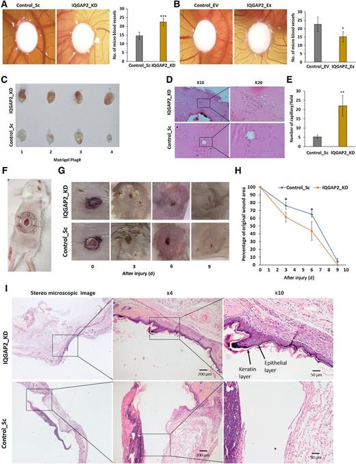Figure 3. Change of IQGAP2 expression in breast cancer cells affects angiogenesis in animal model systems. A, Representative CAM images showing increased number of micro vessels around the paper disc shocked in conditioned medium (CM) from IQGAP2-depleted (IQGAP2_KD) MCF7 than the control group (Control_Sc). The images were taken at day 13 using a stereo microscope. Bar graph showing significant difference in number of micro blood vessels between the two groups (n = 5, two-tailed unpaired t test). B, Representative CAM images, indicating reduced number of micro vessels around the paper disc soaked in CM from IQGAP2 overexpression (IQGAP2_Ex) MCF7 than the control (Control_EV) group. Representative micro blood vessels (blood vessels sprouting out from macro blood vessels and growing toward the filter disc) are shown with black arrows. The bar graph shows the difference in number of micro blood vessels between the groups (n = 5, two-tailed unpaired t test). C, Image showing gross overview of Matrigel plugs (excised on day 10 from mice) that were treated with Matrigel and CM from IQGAP2-depleted (IQGAP2_KD) MCF7 and control groups (Control_Sc; n = 4). D, Representative H&E images at ×10 and ×20 magnifications showing more blood vessels formation in Matrigel plugs that were treated with the IQGAP2-depleted (IQGAP2_KD) MCF7 group than in the control group (Control_Sc; n = 4). E, Bar graph displaying difference in the number of capillaries/field formed in plugs of IQGAP2-depleted MCF7 (IQGAP2_KD) and control (Control_Sc) groups (n = 4, two-tailed unpaired t test). F, Image displaying the wound-healing model used in this study. G, Representative images showing the wound-healing process in the IQGAP2-depleted (IQGAP2_KD) MCF7 and control groups (Control_Sc) on different days. H, Graph showing difference in the percentage of wound recovery between IQGAP2-depleted (IQGAP2_KD) MCF7 and control (Control_Sc) groups (n = 3, two-tailed unpaired t test). I, H&E staining showing thicker keratin layer in the IQGAP2-depleted (IQGAP2_KD) MCF7 group than the control group (Control_Sc; day 6). The image of the gross wound and normal area was captured with the stereo microscope (left). The magnified images of the wound area were taken at ×4 (middle) and ×10 objectives (right) in the brightfield microscope. The newly generated keratin and epithelial layer is shown with arrows at ×10 magnified image; *, P ≤ 0.05; **, P ≤ 0.01; ***, P ≤ 0.001. The results were presented as mean ± SD.