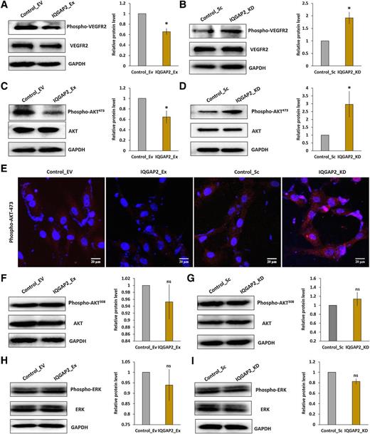 Figure 6. IQGAP2 modulation in breast cancer cells induces phospho-VEGFR2 and phospho-AKT473 in HUVECs. Conditioned media (CM) from IQGAP2 modulated breast cancer cells were applied on HUVECs and, after 24 hours of incubation, protein lysates were prepared. Western blots were performed against phospho-VEGFR2, phospho-AKT473, phospho-AKT308, phospho-ERK or the total proteins. GAPDH was used as the loading control. A–D, Here, Western blot images showing (A) reduced expression of phospho-VEGFR2 but not of total-VEGFR2 in IQGAP2 overexpression (IQGAP2_Ex) MCF7 group (n = 3, two-tailed unpaired t test). B, Increased protein level of phospho-VEGFR2 in the IQGAP2-depleted (IQGAP2_KD) MCF7 group (n = 3, two-tailed unpaired t test). C, Reduced expression of phospho-AKT473 but not total AKT in the IQGAP2 overexpression (IQGAP2_Ex) MCF7 group (n = 3, two-tailed unpaired t test). D, Increased phospho-AKT473 expression but not total AKT in the IQGAP2-depleted (IQGAP2_KD) MCF7 group (n = 3, two-tailed unpaired t test). E, Immunocytochemistry images showing the levels of phospho-AKT473 (red, Alexa594) in HUVECs treated with CM derived from MCF7 cells with IQGAP2 overexpression (IQGAP2_Ex) and respective controls (Control_EV) and, MCF7 with IQGAP2 depletion (IQGAP2_KD) and respective controls (Control_Sc). Counter-staining for nucleus was performed using DAPI (blue). F–G, No changes in expression of phospho-AKT308 were observed in (F) IQGAP2 overexpression (IQGAP2_Ex) MCF7 and (G) IQGAP2-depleted (IQGAP2_KD) MCF7 (n = 3, two-tailed unpaired t test). H and I, No expression changes observed in phospho-ERK in (H) IQGAP2 overexpression (IQGAP2_Ex) MCF7 or (I) IQGAP2-depleted (IQGAP2_KD) MCF7 (n = 3, two-tailed unpaired t test). ns, nonsignificant; *, P ≤ 0.05. The results were presented as mean ± SD values from three independent experiments.