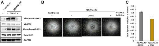 Figure 7. IQGAP2 affects breast cancer angiogenesis through VEGFR2 receptor. A and B, VEGFR2 activation was inhibited using VEGFR2 inhibitor II or solvent, in HUVECs that were cultured in conditioned medium from IQGAP2-depleted MCF7 cells. A, the Western blot images showing rescue of phospho-AKT473 expression in the VEGFR2 inhibitor group but not in the vehicle control group (n = 3). B, Tubule formation assay images showing the status of tubes in HUVECs after treatment with VEGFR2 inhibitor or vehicle control in MCF7_IQGAP2_KD background. These images are the representative images of tubules after processing in Angiogenesis analyzer software, ImageJ analyzer. C, MCF7 cells with IQGAP2 depletion were treated with ERK inhibitor (U0126) or solvent and VEGF-A levels were analyzed by ELISA. Bar graph showing reduction of VEGF-A level in the IQGAP2-depleted MCF7 (IQGAP2_KD) group treated with ERK inhibitor compared with that of vehicle control (DMSO). In bar graph, the x-axis showing the absorbance of ELISA at 450 nm, the y-axis shows the IQGAP2-depleted MCF7 group treated with vehicle control (IQGAP2_KD+DMSO) or ERK inhibitor (IQGAP2_KD+ERKi). (n = 3, two-tailed unpaired t test). ***, P ≤ 0.001. The results were presented as mean ± SD values from three independent experiments.