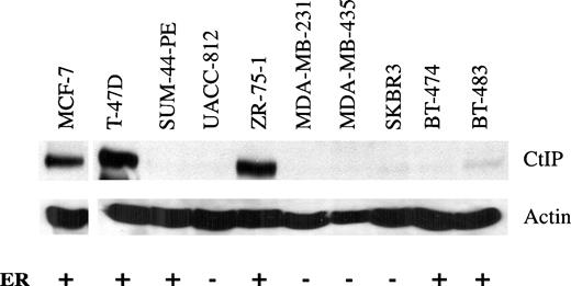 FIGURE 2. CtIP protein expression in breast cancer cell lines as determined by Western blot analysis. ER expression status is also indicated as positive (+) or negative (−). As can be observed, all ER− breast cancer lines (100%) tested do not express CtIP protein, whereas four of six ER+ lines (67%) express this protein.