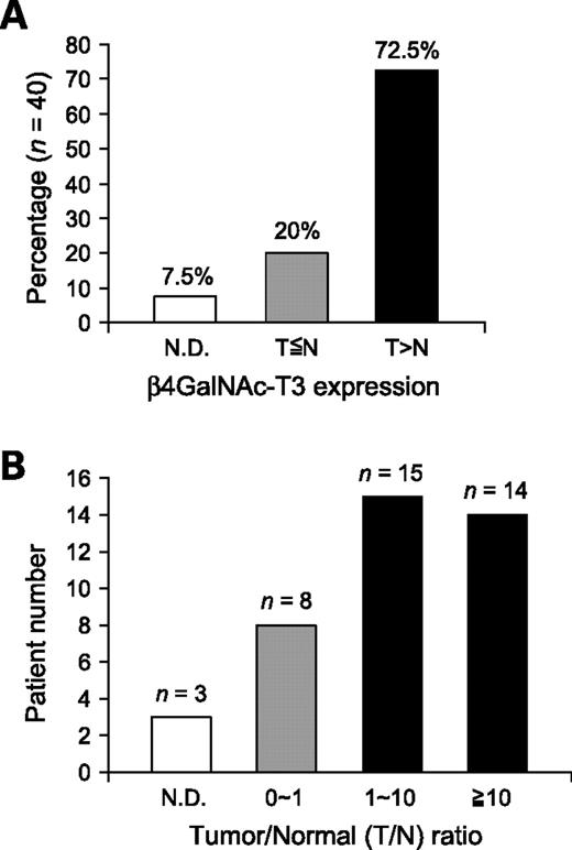 FIGURE 1. Expression of β4GalNAc-T3 in primary colon tumors by real-time RT-PCR. A. β4GalNAc-T3 is frequently up-regulated in colon tumors compared with their normal counterparts. Expression levels of β4GalNAc-T3 in paired colon tissues from 40 patients (n = 40) were analyzed by real-time RT-PCR. The percentages of the three groups were shown. N.D., not detectable; T, tumor; N, normal. B. Of the 40 patients tested, numbers of patients with different tumor/normal (T/N) ratios of β4GalNAc-T3 expression are shown. n, patient number.