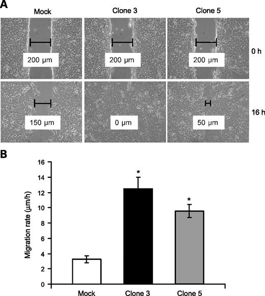 FIGURE 3. β4GalNAc-T3 enhances cell migration. A. β4GalNAc-T3 overexpression enhances cell migration analyzed by wound healing assays. Confluent cells were scraped with a 250-μL tip for 200 μm and observed for 16 h. Representative images are shown at the indicated times. Lines, clear regions of scraped areas; the distance (μm) is as indicated. Magnification, ×200. B. Migration rate of mock (open column) and β4GalNAc-T3 (black and gray columns) transfectants is presented as migration distance (μm)/time (h). Three independent experiments were analyzed. *, P < 0.01, compared with mock transfectants.