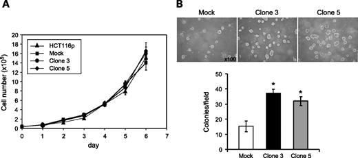 FIGURE 5. Effects of β4GalNAc-T3 expression on anchorage-dependent and anchorage-independent cell growth. A. Anchorage-dependent cell growth is not affected by β4GalNAc-T3. Viable cells were observed for 6 d and analyzed by trypan blue exclusion assays, which were quantified from three independent experiments. B. β4GalNAc-T3 enhances anchorage-independent cell growth of HCT116 cells in soft agar. Mock (open column) and β4GalNAc-T3 (black and gray columns) were seeded into soft agar for 14 d. Colony numbers (colony size >50 μm) were counted under a microscope after crystal violet staining. Magnification, ×100. Columns, mean from three independent experiments; bars, SD. *, P < 0.01, compared with mock transfectants.