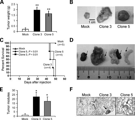 FIGURE 6. β4GalNAc-T3 promotes tumor growth and metastasis and decreases survival in nude mice. A and B. β4GalNAc-T3 promotes tumor growth in vivo. Mock or β4GalNAc-T3 stable transfectants (5 × 106) were injected subcutaneously. into nude mice (n = 5 per group). Mice were sacrificed 20 d after injection. A. The excised mock (open column) or β4GalNAc-T3 (black and gray columns) tumors were weighed. Columns, mean; bars, SD. **, P < 0.001, compared with mock transfectants. B. Tumor size was dramatically increased in mice xenografted with β4GalNAc-T3 stable transfectants. Representative images of tumors; bar, 1 cm. C and D. β4GalNAc-T3 decreases survival of nude mice. C. For survival analysis, nude mice were intraperitoneally injected with mock or β4GalNAc-T3 transfectants as indicated. The survival rate was calculated by the Kaplan-Meier method. The survival rate was significantly lower in mice with β4GalNAc-T3 tumors (P = 0.001; n = 4 for each clone) compared with that in the control mice with mock tumors (n = 5). D. Tumor metastasis was observed in various organs of mice with β4GalNAc-T3 tumors, including kidney, liver, pancreas, and intestine. E and F. β4GalNAc-T3 promotes tumor metastasis in nude mice. E. Average number of tumor nodules in lungs of nude mice. F. Histologic analysis of lung metastasis of mock and β4GalNAc-T3 transfectants. Arrows, tumor nodules. Magnification, ×100.