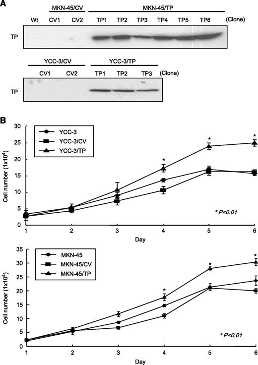 FIGURE 2. TP-overexpressing cells displayed enhanced migration ability. A. The two TP-overexpressing gastric cancer cell lines YCC-3/TP and MKN-45/TP had high TP expression, as evidenced by immunoblotting for TP. B. Doubling times of YCC-3/TP and MKN-45/TP cells.