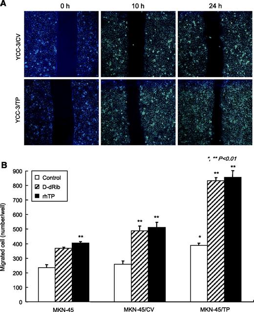 FIGURE 3. A. Confluent monolayers of cells were scratched with a sterile 200-μL pipette tip to form a wound area and then cultured in 0.5% serum medium for 10 and 24 h. Cell migration distances were calculated and compared with the initial distance from the wound area. B. MKN-45 cells (1 × 105) were added to the upper compartment of a Matrigel-precoated transwell chamber and allowed to migrate for 36 h at 37°C. Cell migration was stimulated by the addition of either purified 40 ng/mL rhTP or 40 μmol/L D-dRib to the lower chamber. Columns, mean; bars, SD. *, P < 0.01, compared with MKN-45 cells; **, P < 0.01, compared with untreated controls.