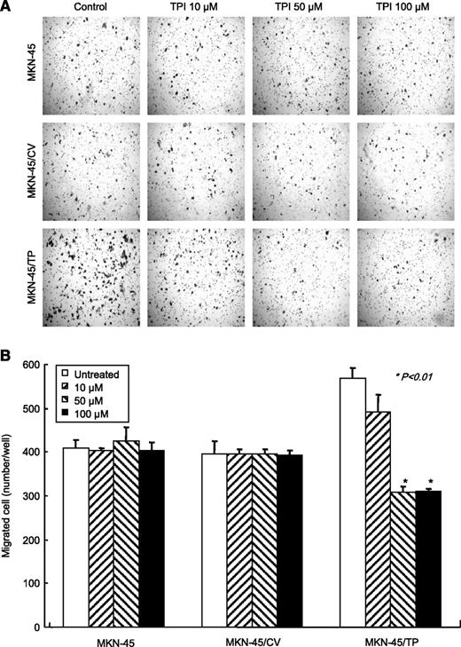 FIGURE 4. TP-induced migration ability was dependent on TP enzymatic activity. MKN-45 cells (1 × 105) were added to the upper compartment of a Matrigel-precoated transwell chamber. TPI was added at concentrations of 10, 50, and 100 μmol/L to the upper compartment and cells were allowed to migrate for 36 h at 37°C. A. Representative figures of Matrigel. B. Quantitative results are represented. Columns, mean; bars, SD. *, P < 0.01, compared with TPI-untreated MKN-45/TP cells.