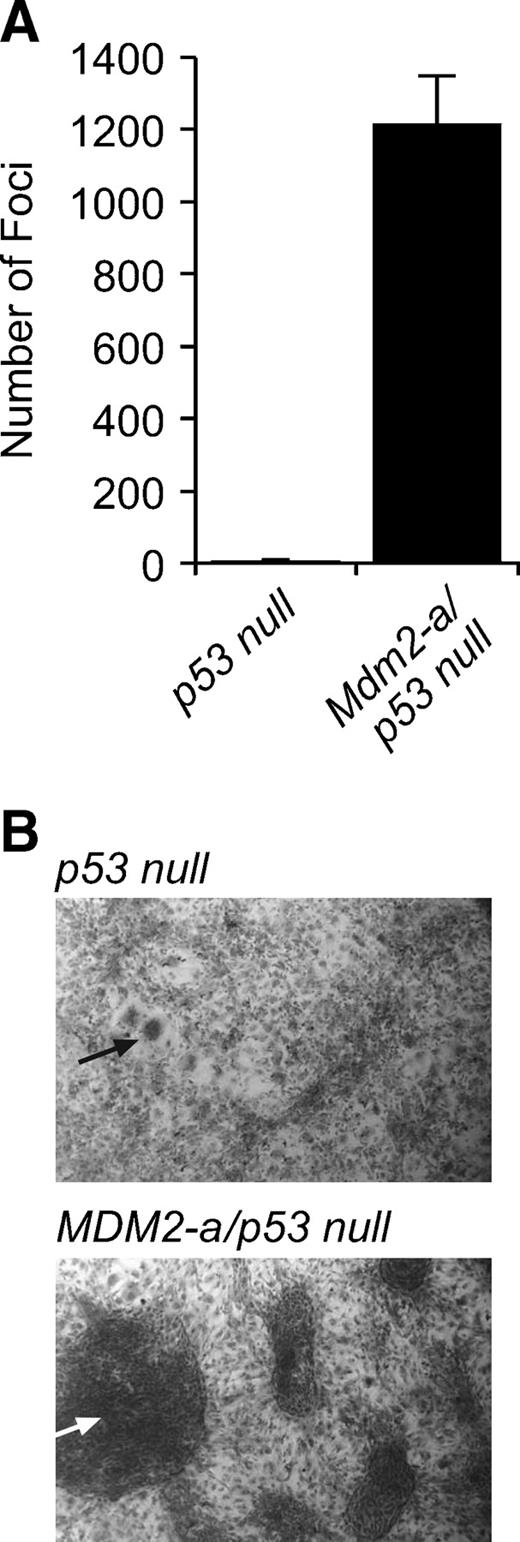FIGURE 4. MDM2-A enhances transformation in the absence of p53. A. Histogram of foci/78.5 cm2 formed in p53-null or Mdm2-a/p53-null MEFs. Columns, mean of three experiments; bars, SD. B. Micrographs of p53-null (top) and Mdm2-a/p53-null (bottom) foci at ×4 magnification. Arrows point to examples of the observed foci.
