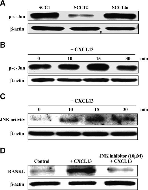 FIGURE 3. c-Jun activation in CXCL13-stimulated OSCC cells. A. Western blot analysis for p-c-Jun expression in OSCC cell lines. B. CXCL13 stimulates p-c-Jun expression in SCC14a cells. The SCC14a cells were stimulated with CXCL13 (25 ng/mL) for different time points (0-30 min). Total cell lysates obtained were analyzed by Western blot for p-c-Jun expression. C. CXCL13 stimulates JNK activity in SCC14a cells. The cells were stimulated with CXCL13 (25 ng/mL) for different time points (0-30 min). The total cell lysates prepared were assayed for JNK activity using an SAPK/JNK assay kit (Cell Signaling) by Western blot analysis. β-Actin levels shown represent equal amount of total cell lysates used for the study. D. JNK inhibitor blocked expression of CXCL13-induced RANKL expression. SCC14a cells were treated with JNK inhibitor (SP600125) at 10 μmol/L concentration for 6 h before the CXCL13 (25 ng/mL) treatment for 48 h. Total cell lysates were analyzed by Western blot for RANKL expression. β-Actin expression serves as loading control. Data shown in Western blot analysis represent three independent experiments. The band intensity on Western blots was quantified by densitometric analysis using the NIH ImageJ Program.